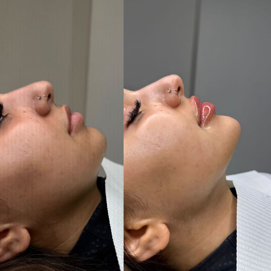 69EB8860-36CB-4211-8DD7-2DB8A3EDD71B